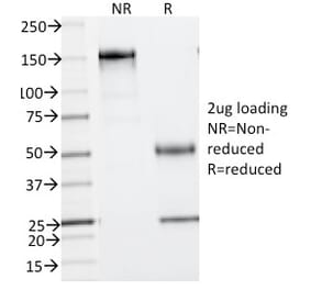 SDS-PAGE - Anti-Phosphotyrosine Antibody [PY793] - BSA and Azide free (A254115) - Antibodies.com