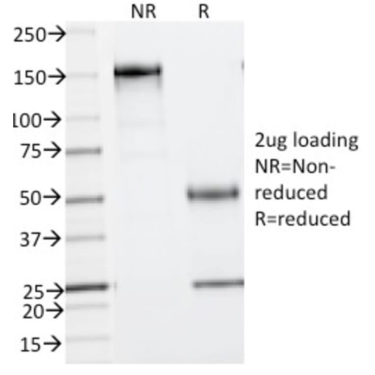 SDS-PAGE - Anti-Phosphotyrosine Antibody [PY793] - BSA and Azide free (A254115) - Antibodies.com