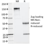 SDS-PAGE - Anti-Phosphotyrosine Antibody [PY793] - BSA and Azide free (A254115) - Antibodies.com