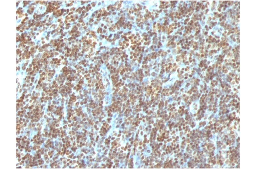 Immunohistochemistry - Anti-ds DNA Antibody [AE-2] - BSA and Azide free (A254118) - Antibodies.com