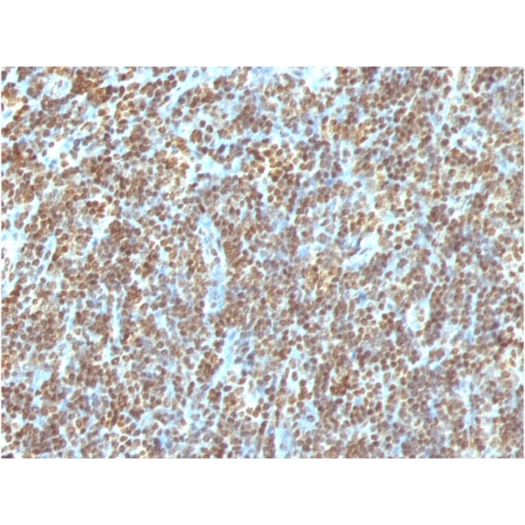 Immunohistochemistry - Anti-ds DNA Antibody [AE-2] - BSA and Azide free (A254118) - Antibodies.com