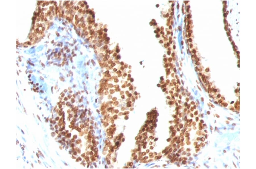 Immunohistochemistry - Anti-ds DNA Antibody [AE-2] - BSA and Azide free (A254117) - Antibodies.com