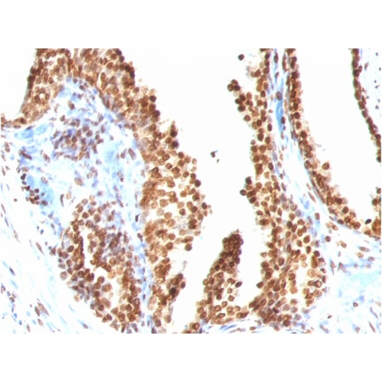 Immunohistochemistry - Anti-ds DNA Antibody [AE-2] - BSA and Azide free (A254117) - Antibodies.com