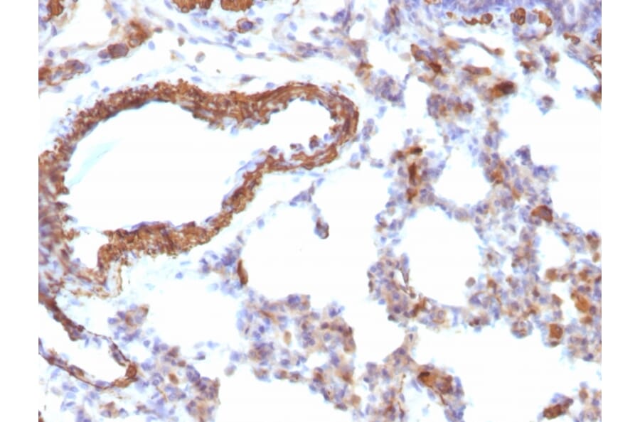 Immunohistochemistry - Anti-Muscle Actin Antibody [MSA/953] - BSA and Azide free (A254119) - Antibodies.com