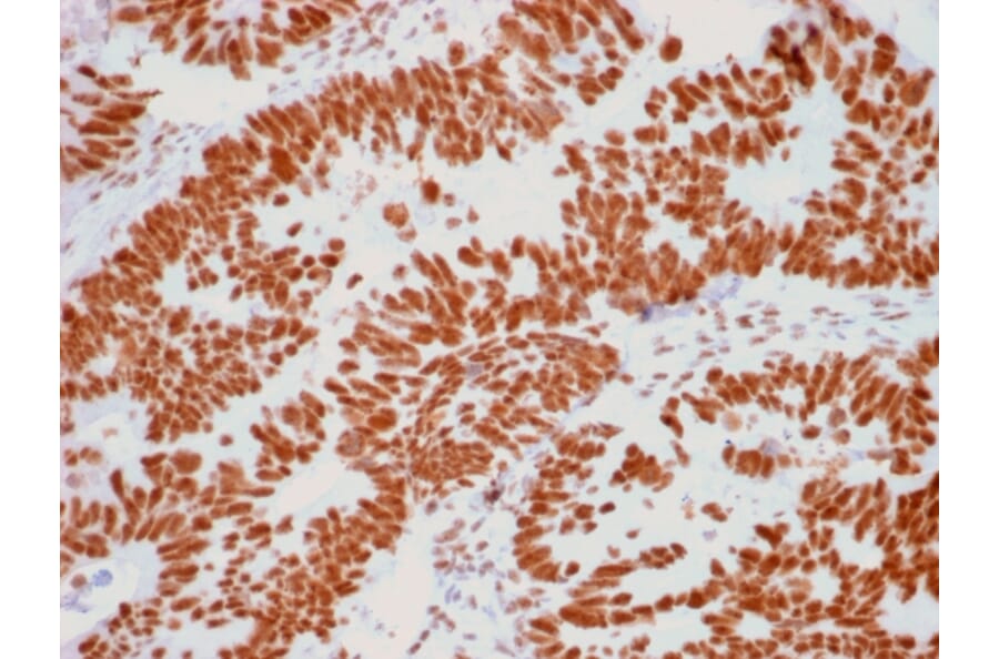 Immunohistochemistry - Anti-Human Nucleolar Antigen Antibody [NM95] - BSA and Azide free (A254120) - Antibodies.com