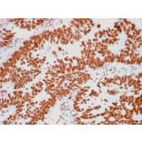Immunohistochemistry - Anti-Human Nucleolar Antigen Antibody [NM95] - BSA and Azide free (A254120) - Antibodies.com