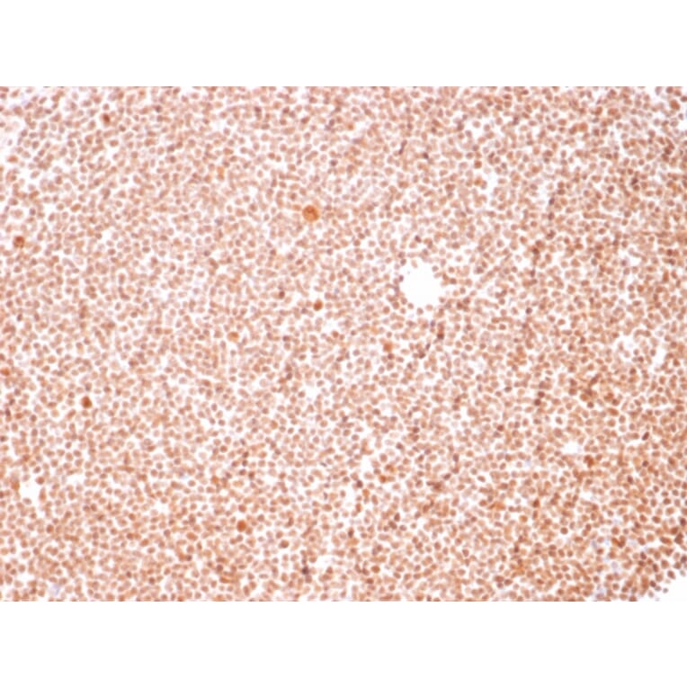 Immunohistochemistry - Anti-Human Nucleolar Antigen Antibody [NM95] - BSA and Azide free (A254120) - Antibodies.com