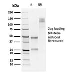 SDS-PAGE - Anti-Human Nucleolar Antigen Antibody [NM95] - BSA and Azide free (A254120) - Antibodies.com