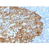 Immunohistochemistry - Anti-Keratin 76 Antibody [DE-SQ] - BSA and Azide free (A250941) - Antibodies.com