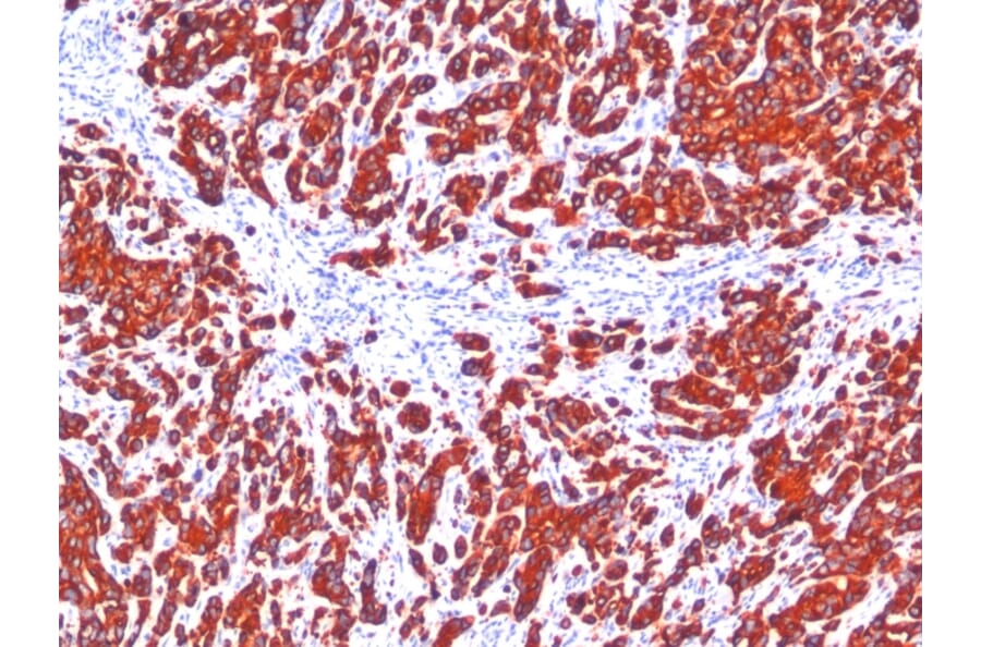 Immunohistochemistry - Anti-pan Cytokeratin Antibody [SPM115 + SPM116] - BSA and Azide free (A254123) - Antibodies.com