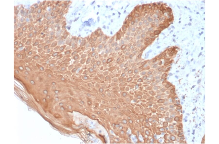 Immunohistochemistry - Anti-pan Cytokeratin Antibody [rKRT/457] - BSA and Azide free (A254126) - Antibodies.com
