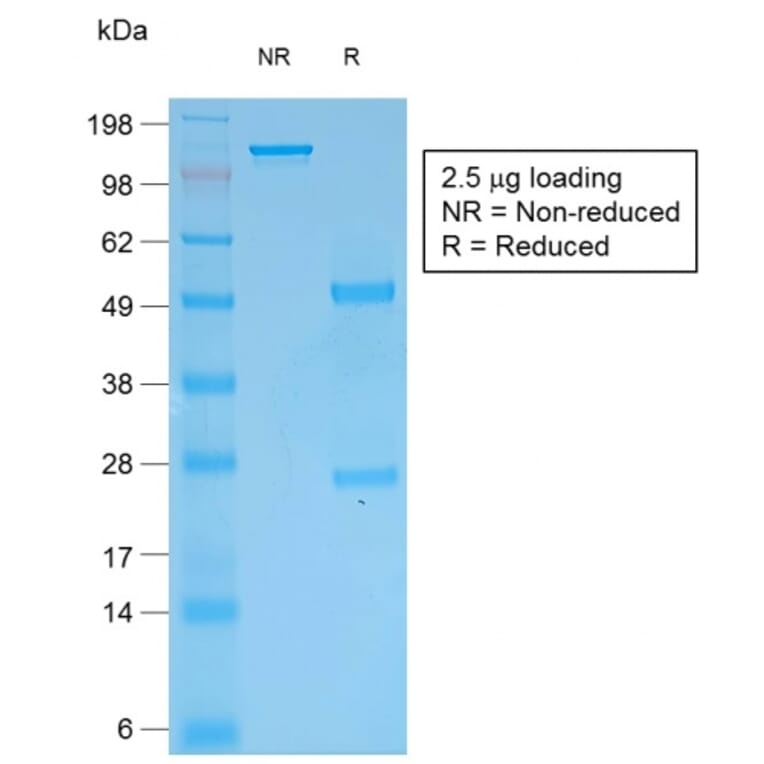 SDS-PAGE - Anti-pan Cytokeratin Antibody [rKRT/457] - BSA and Azide free (A254127) - Antibodies.com