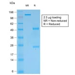 SDS-PAGE - Anti-pan Cytokeratin Antibody [rKRT/457] - BSA and Azide free (A254127) - Antibodies.com