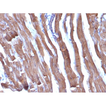 Immunohistochemistry - Anti-Muscle Actin Antibody [HHF35 + MSA/953] - BSA and Azide free (A254128) - Antibodies.com