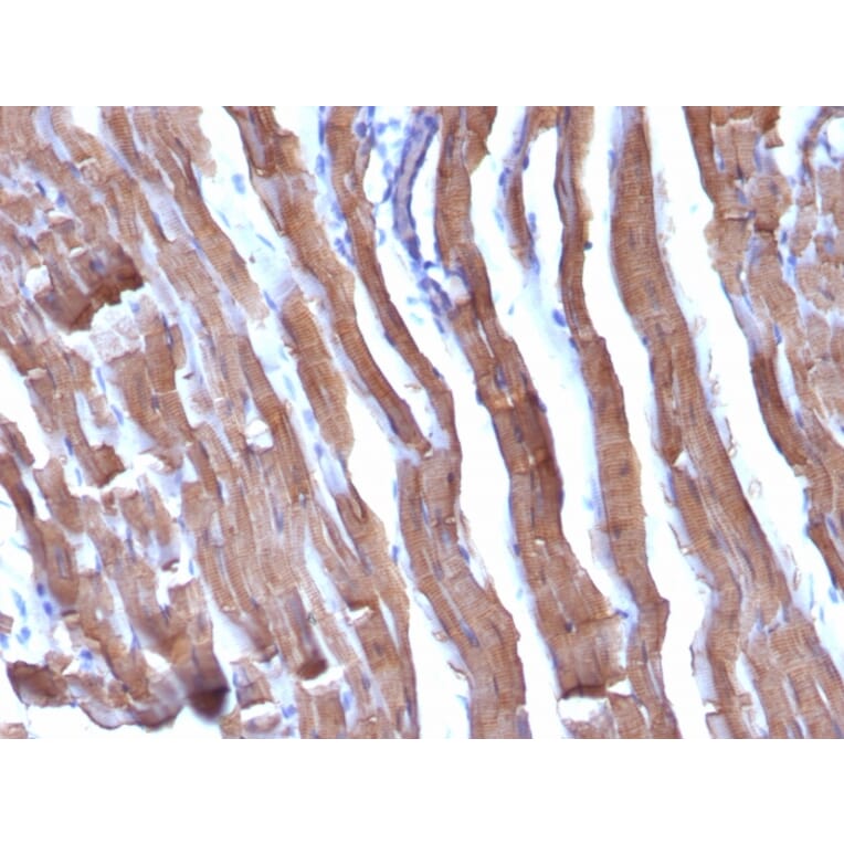 Immunohistochemistry - Anti-Muscle Actin Antibody [HHF35 + MSA/953] - BSA and Azide free (A254128) - Antibodies.com