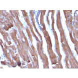 Immunohistochemistry - Anti-Muscle Actin Antibody [HHF35 + MSA/953] - BSA and Azide free (A254128) - Antibodies.com