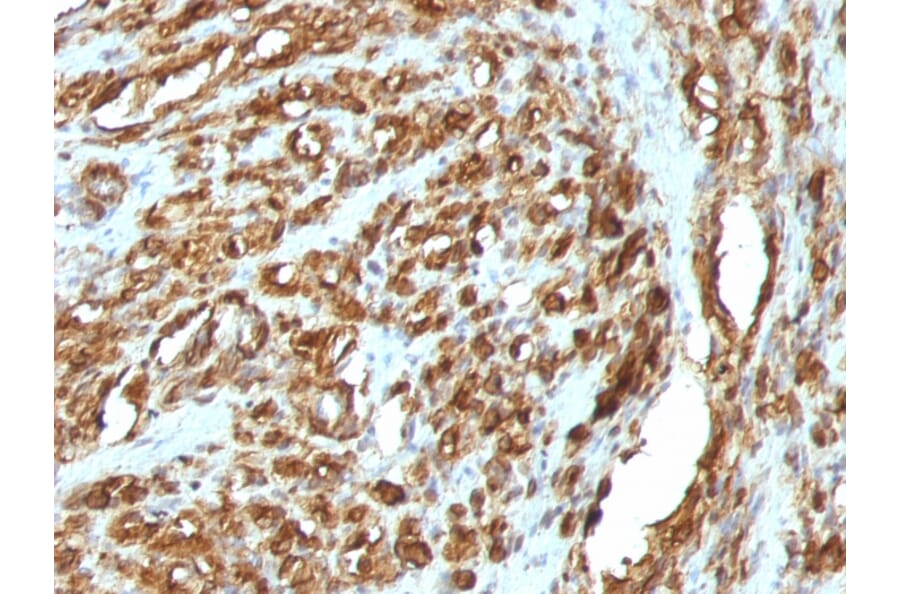Immunohistochemistry - Anti-Muscle Actin Antibody [HHF35 + MSA/953] - BSA and Azide free (A254128) - Antibodies.com