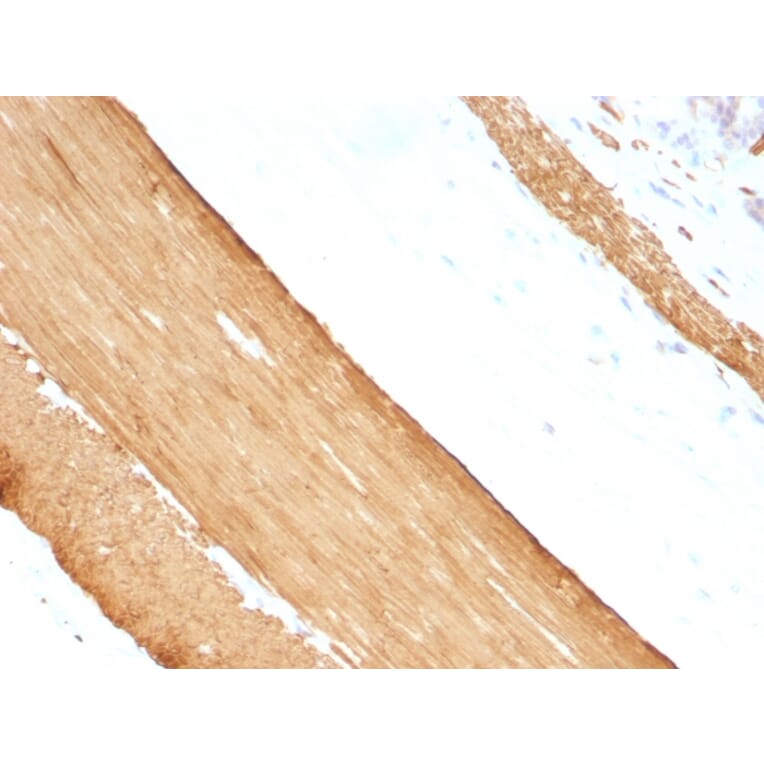 Immunohistochemistry - Anti-Muscle Actin Antibody [HHF35 + MSA/953] - BSA and Azide free (A254128) - Antibodies.com