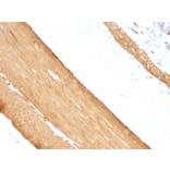 Immunohistochemistry - Anti-Muscle Actin Antibody [HHF35 + MSA/953] - BSA and Azide free (A254128) - Antibodies.com