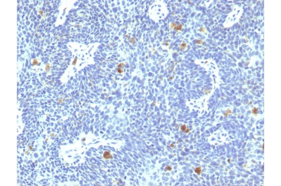 Immunohistochemistry - Anti-HPV16 E6 Antibody [HPV16/1295] - BSA and Azide free (A254128) - Antibodies.com