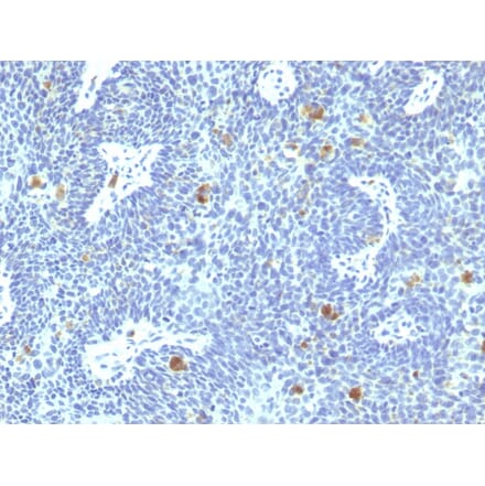 Immunohistochemistry - Anti-HPV16 E6 Antibody [HPV16/1295] - BSA and Azide free (A254128) - Antibodies.com