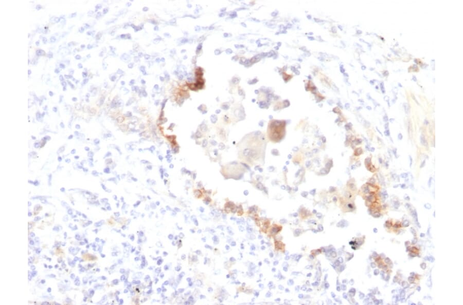 Immunohistochemistry - Anti-Blood Group Lewis y Antibody [LWY/1463] - BSA and Azide free (A254131) - Antibodies.com