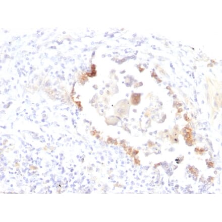 Immunohistochemistry - Anti-Blood Group Lewis y Antibody [LWY/1463] - BSA and Azide free (A254131) - Antibodies.com