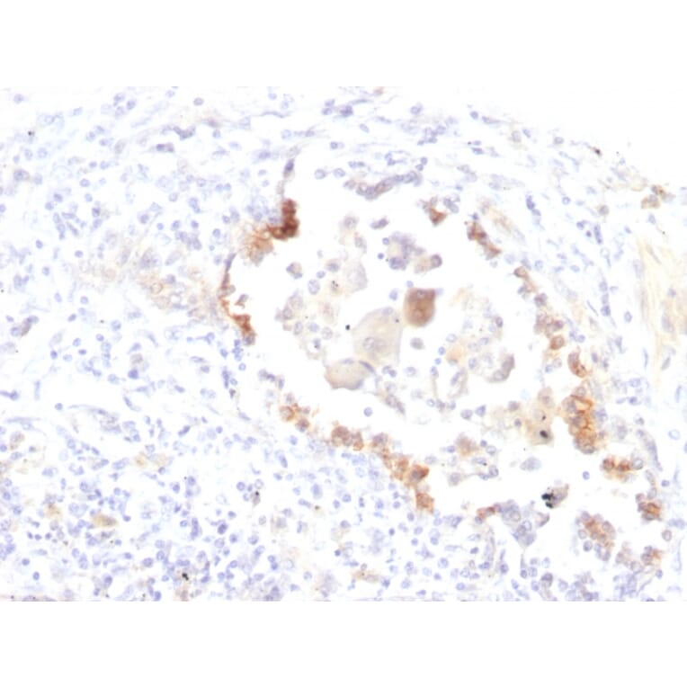 Immunohistochemistry - Anti-Blood Group Lewis y Antibody [LWY/1463] - BSA and Azide free (A254131) - Antibodies.com