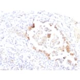 Immunohistochemistry - Anti-Blood Group Lewis y Antibody [LWY/1463] - BSA and Azide free (A254131) - Antibodies.com