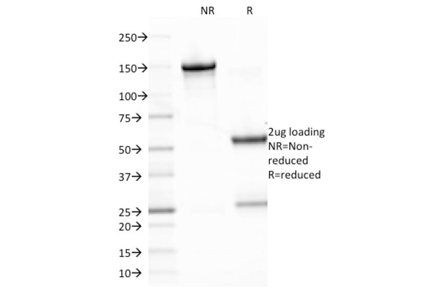 SDS-PAGE - Anti-EBV LMP-1 Antibody [CS2] - BSA and Azide free (A254132) - Antibodies.com