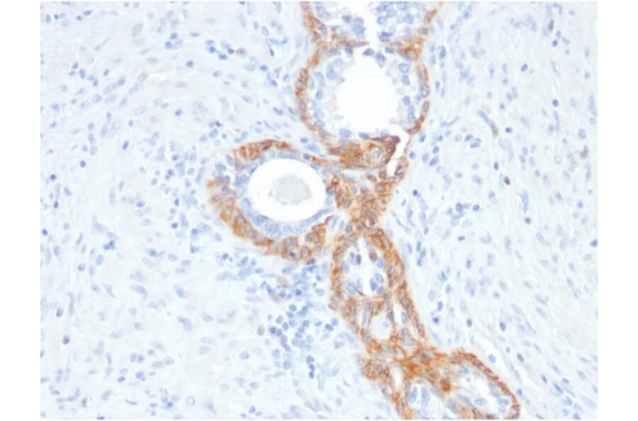Immunohistochemistry - Anti-Keratin 76 Antibody [rKRTH/2148] - BSA and Azide free (A250954) - Antibodies.com