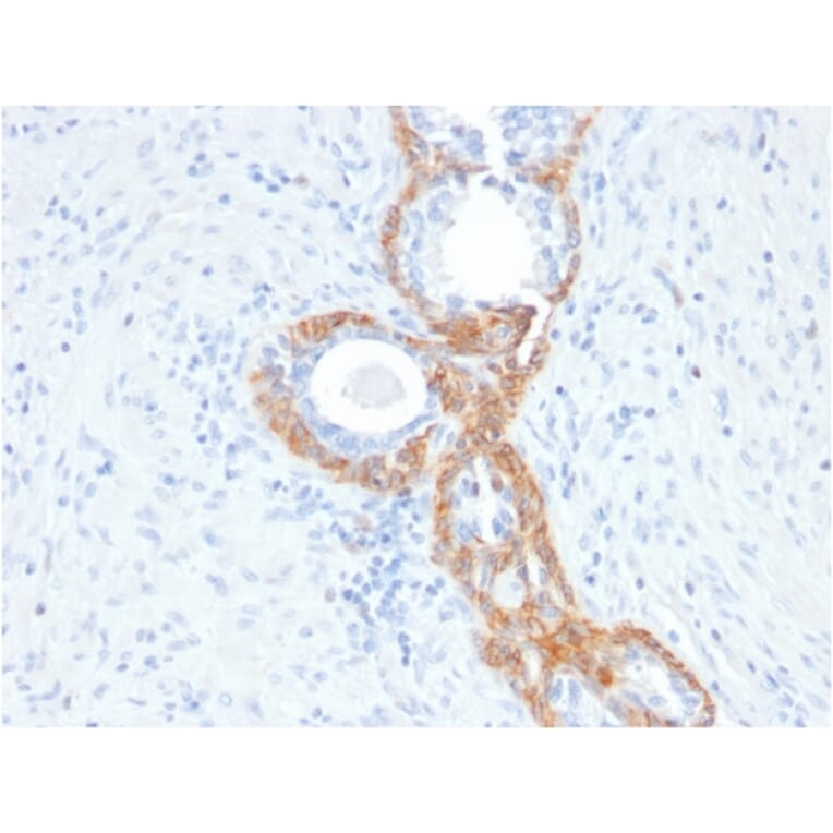 Immunohistochemistry - Anti-Keratin 76 Antibody [rKRTH/2148] - BSA and Azide free (A250954) - Antibodies.com