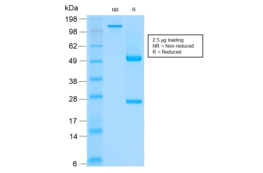 SDS-PAGE - Anti-Keratin 76 Antibody [rKRTH/2148] - BSA and Azide free (A250954) - Antibodies.com