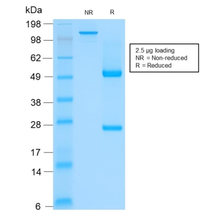 SDS-PAGE - Anti-Keratin 76 Antibody [rKRTH/2148] - BSA and Azide free (A250954) - Antibodies.com