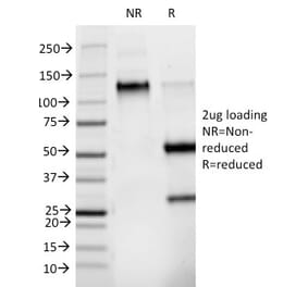 SDS-PAGE - Anti-Phosphotyrosine Antibody [PY265] - BSA and Azide free (A254134) - Antibodies.com