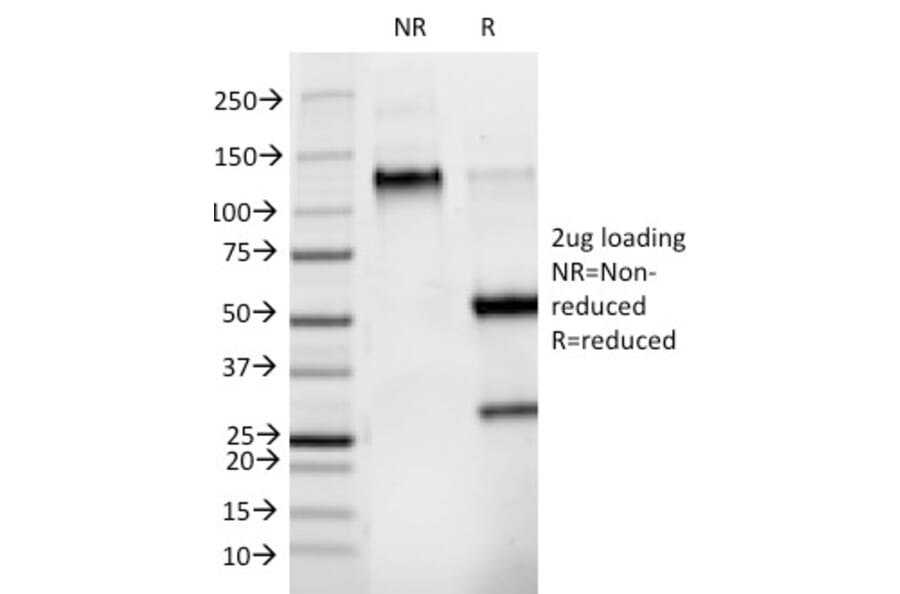 SDS-PAGE - Anti-Phosphotyrosine Antibody [PY265] - BSA and Azide free (A254134) - Antibodies.com