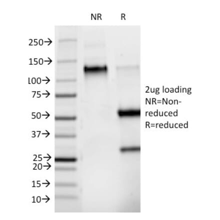 SDS-PAGE - Anti-Phosphotyrosine Antibody [PY265] - BSA and Azide free (A254134) - Antibodies.com