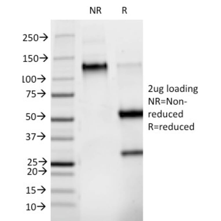 SDS-PAGE - Anti-Phosphotyrosine Antibody [PY265] - BSA and Azide free (A254134) - Antibodies.com