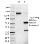 SDS-PAGE - Anti-Phosphotyrosine Antibody [PY265] - BSA and Azide free (A254134) - Antibodies.com