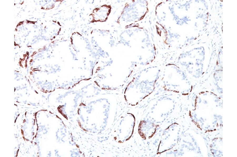 Immunohistochemistry - Anti-Keratin 76 Antibody [34BE12] - BSA and Azide free (A254137) - Antibodies.com