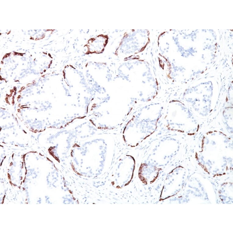 Immunohistochemistry - Anti-Keratin 76 Antibody [34BE12] - BSA and Azide free (A254137) - Antibodies.com