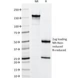 SDS-PAGE - Anti-Keratin 76 Antibody [34BE12] - BSA and Azide free (A254137) - Antibodies.com