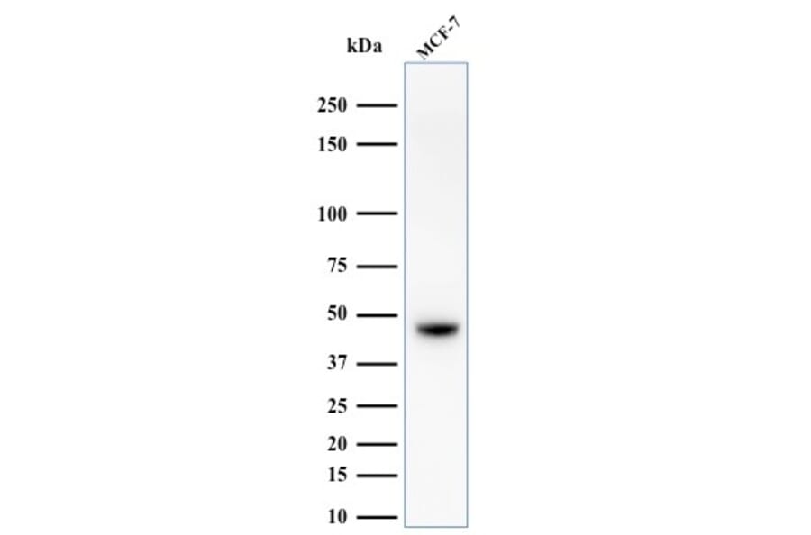 Western Blot - Anti-Keratin 76 Antibody [34BE12] - BSA and Azide free (A254137) - Antibodies.com