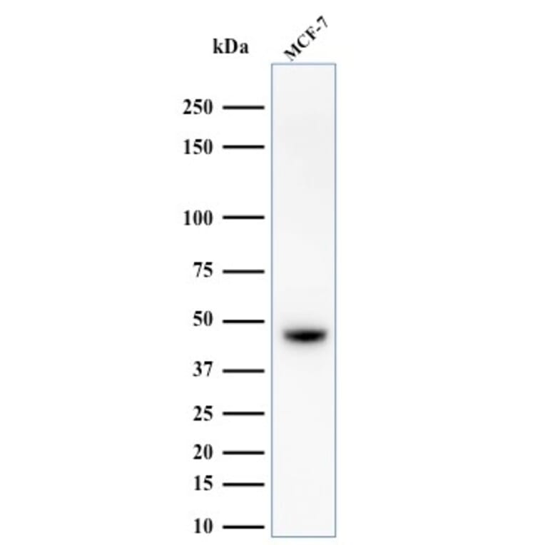 Western Blot - Anti-Keratin 76 Antibody [34BE12] - BSA and Azide free (A254137) - Antibodies.com