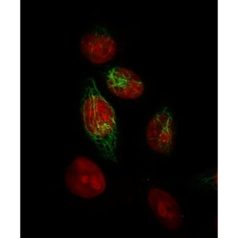 Immunofluorescence - Anti-Keratin 76 Antibody [34BE12] - BSA and Azide free (A254136) - Antibodies.com