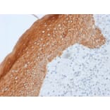 Immunohistochemistry - Anti-Cytokeratin 5 + 6 + 18 Antibody [LP34] - BSA and Azide free (A254138) - Antibodies.com