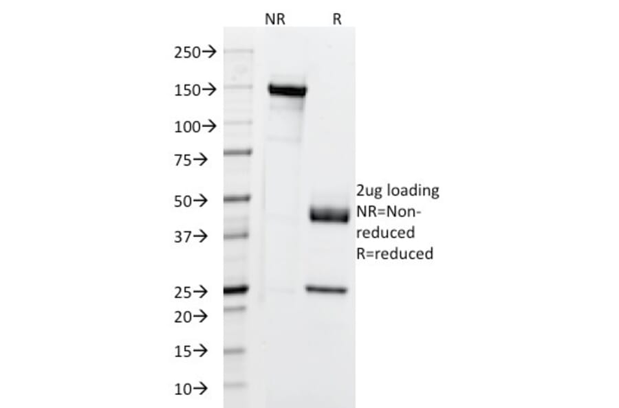 SDS-PAGE - Anti-Cytokeratin 5 + 6 + 18 Antibody [LP34] - BSA and Azide free (A254139) - Antibodies.com