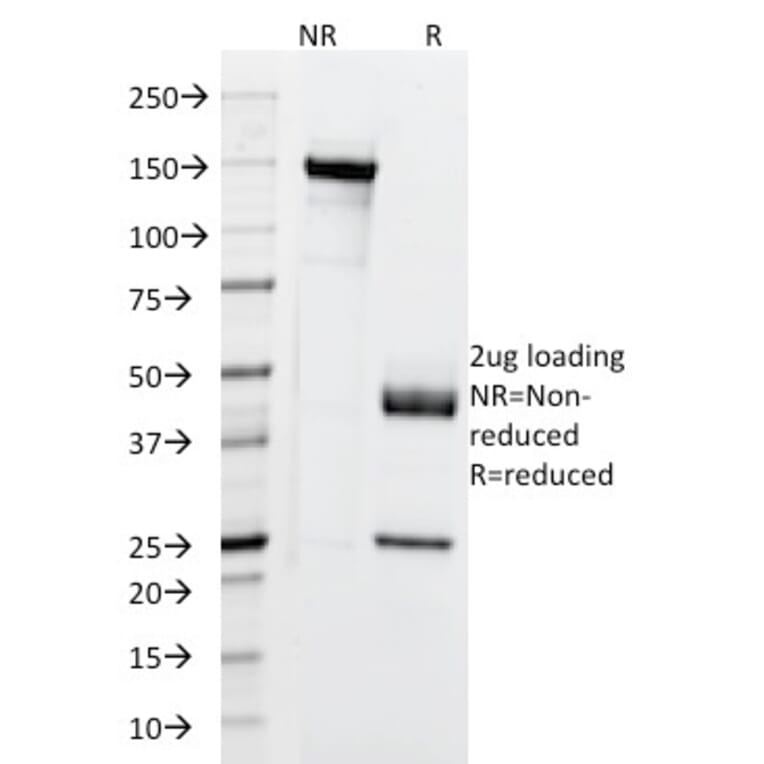SDS-PAGE - Anti-Cytokeratin 5 + 6 + 18 Antibody [LP34] - BSA and Azide free (A254139) - Antibodies.com