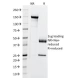SDS-PAGE - Anti-Cytokeratin 5 + 6 + 18 Antibody [LP34] - BSA and Azide free (A254139) - Antibodies.com