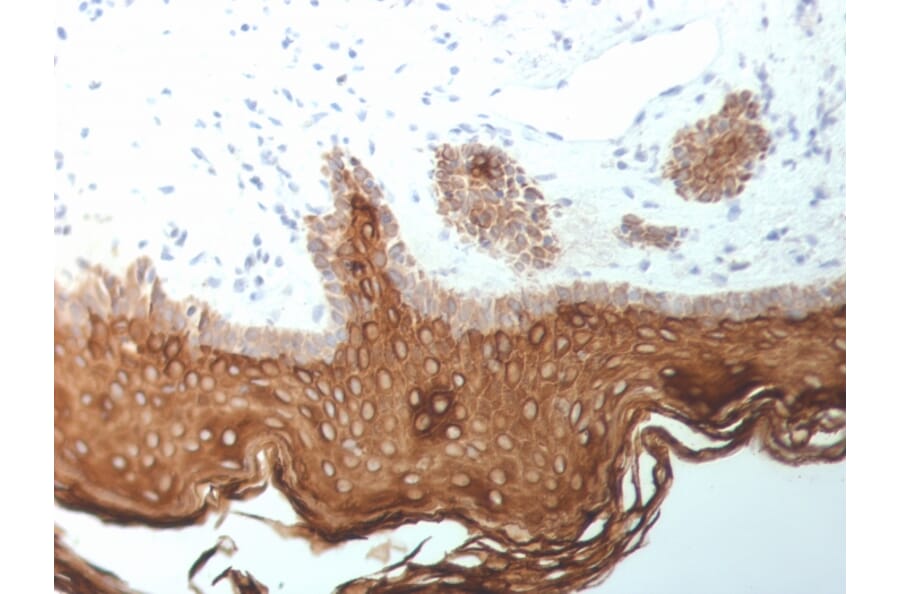 Immunohistochemistry - Anti-Cytokeratin 5 + 6 + 18 Antibody [SPM267] - BSA and Azide free (A254139) - Antibodies.com